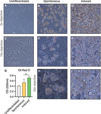 Raman microspectroscopy reveals unsaturation heterogeneity at the lipid droplet level and validates an in vitro model of bone marrow adipocyte subtypes